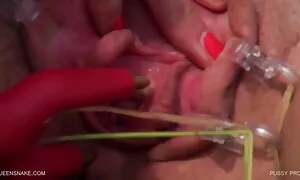 واژن بیمار را گیفسکسی خفن تمیز کرده و با پمپ آشنا شوید